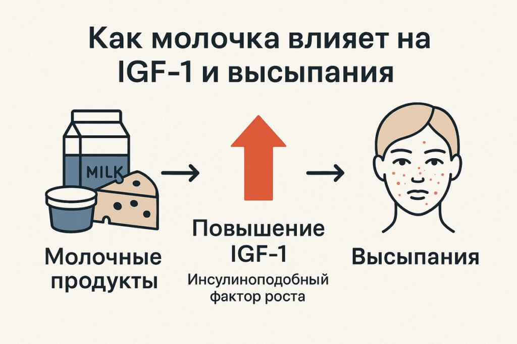 Механизм связи молочных продуктов с акне: сывороточный белок и казеин стимулируют выброс IGF-1, который активирует андрогенные рецепторы в сальной железе и провоцирует воспаление